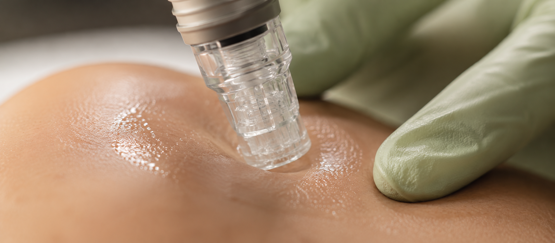 HydraFacial tip on hydrated skin
