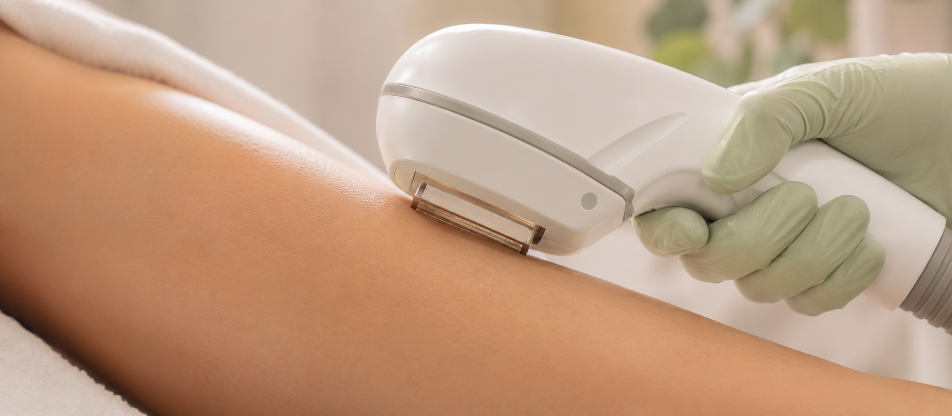 Laser hair removal handpiece on leg
